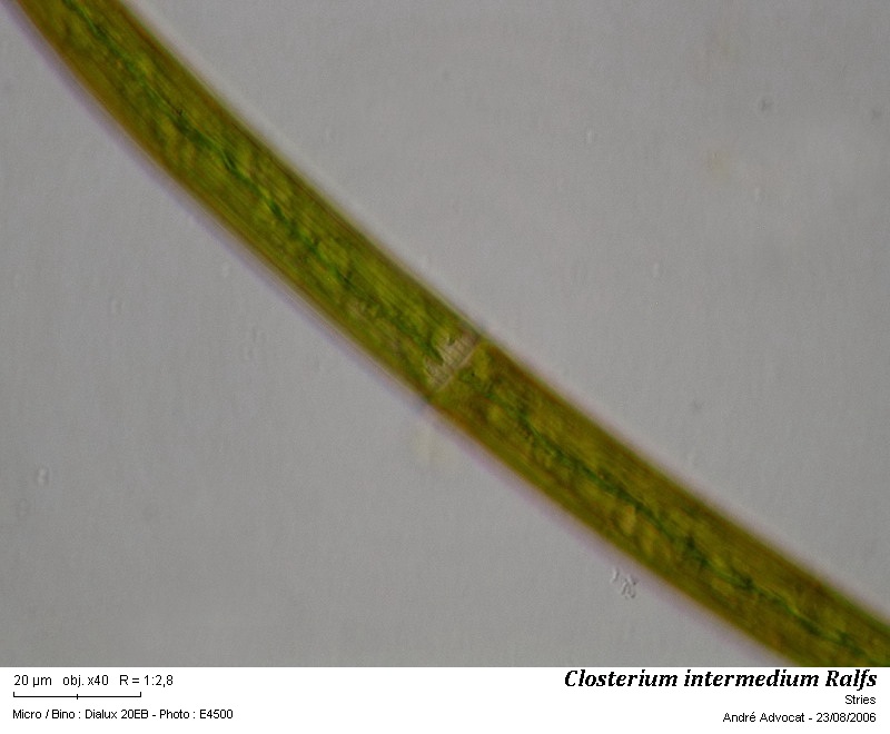 Closterium intermedium Ralfs #56280