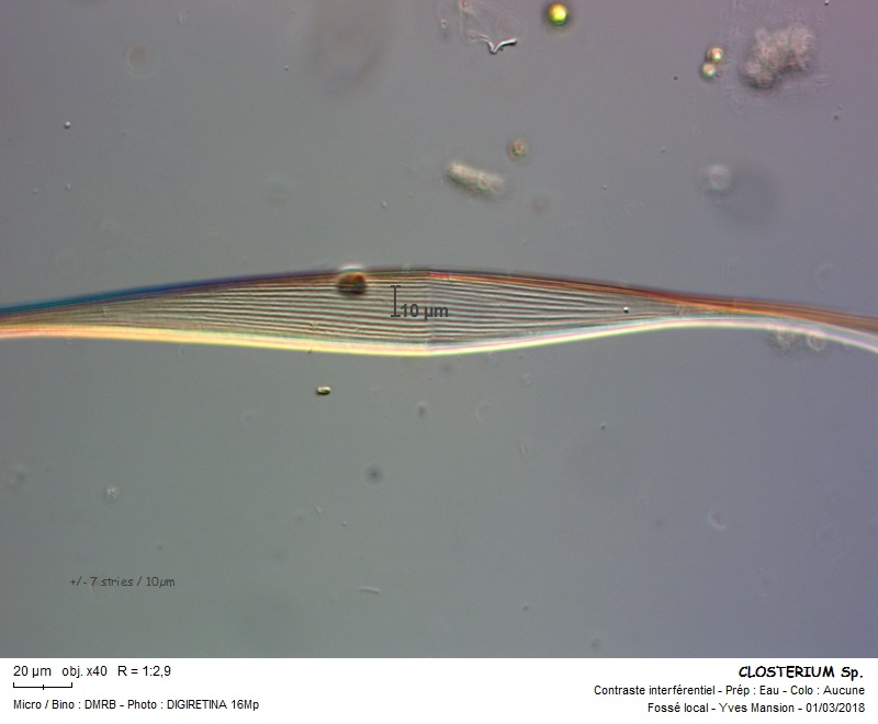 Closterium kuetzingii #59146