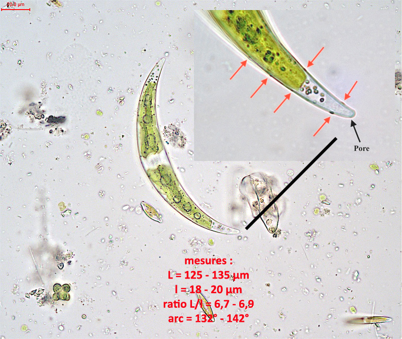 Closterium leibleinii #80679