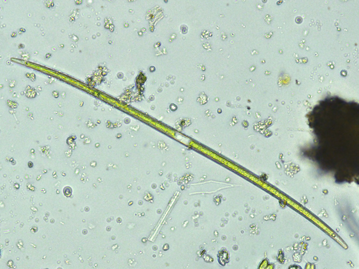 Closterium limneticum Lemmermann, 1899 #70253
