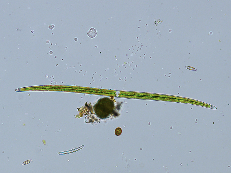 Closterium lineatum RALFS, 1848 #57050
