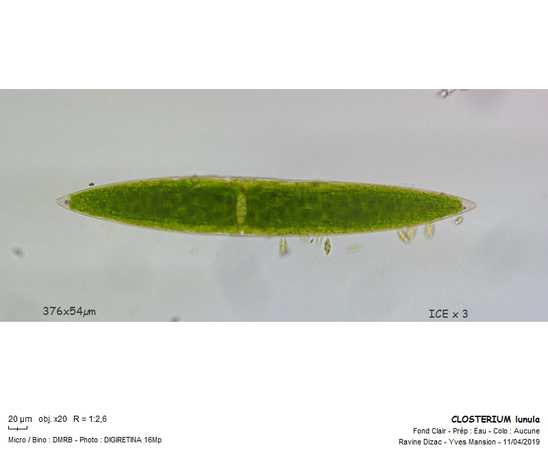 CLOSTERIUM lunula #58791