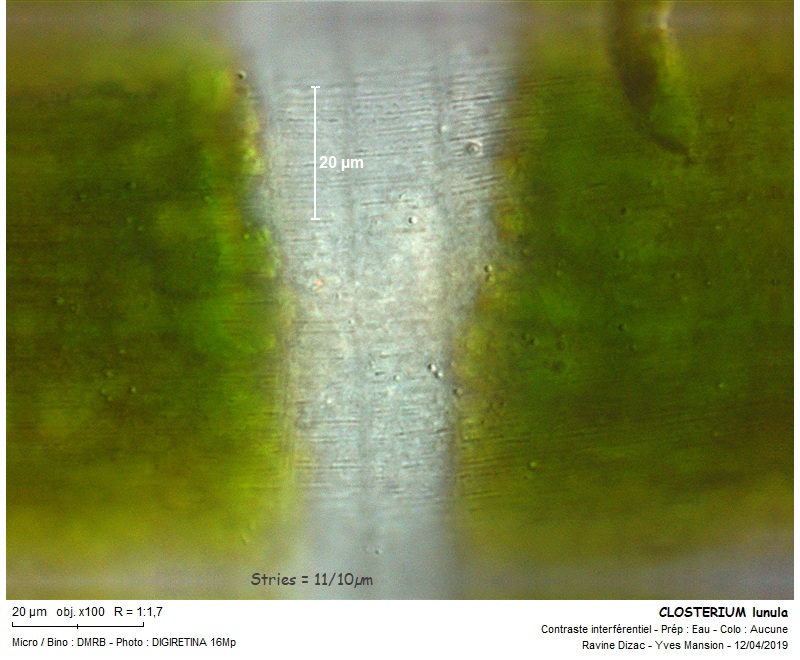 CLOSTERIUM lunula #58790