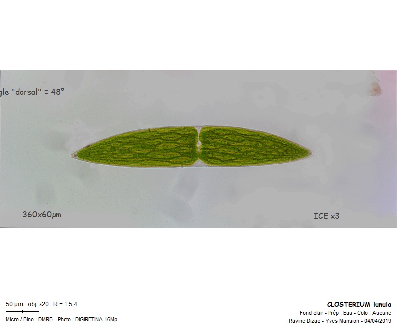 CLOSTERIUM lunula #58786