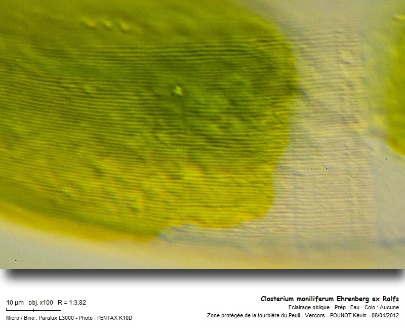 Closterium moniliferum (Bory) Ehrenberg ex Ralfs #26409