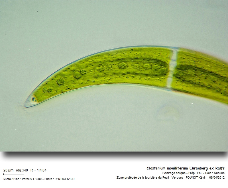 Closterium moniliferum (Bory) Ehrenberg ex Ralfs #26407