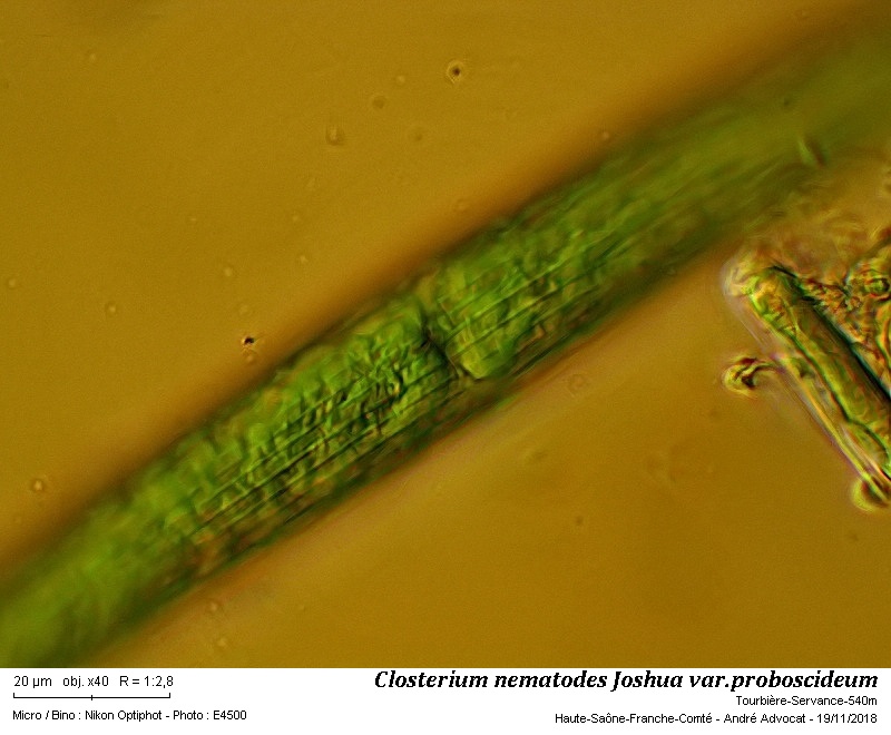 Closterium nematodes Joshua var. proboscideum W. B. Turner #56924