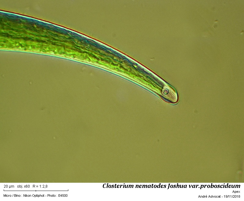 Closterium nematodes Joshua var. proboscideum W. B. Turner #56925