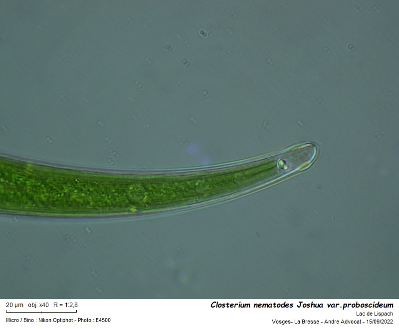 Closterium nematodes Joshua var. proboscideum W. B. Turner #72014