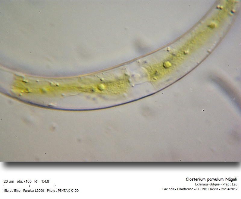 Closterium parvulum Nägeli #26722