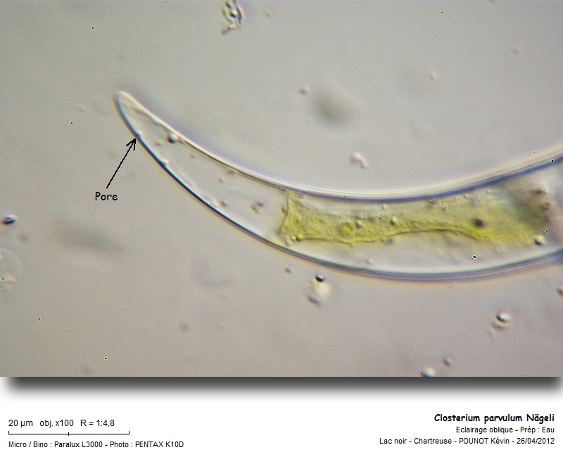 Closterium parvulum Nägeli #26723