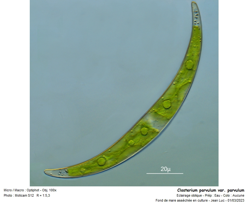 Closterium parvulum var. parvulum #73761