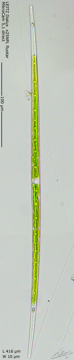 Closterium pronum #66112