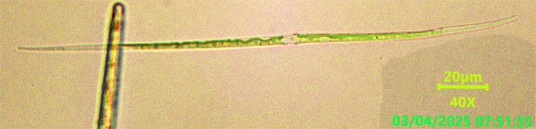 Closterium pronum #82065