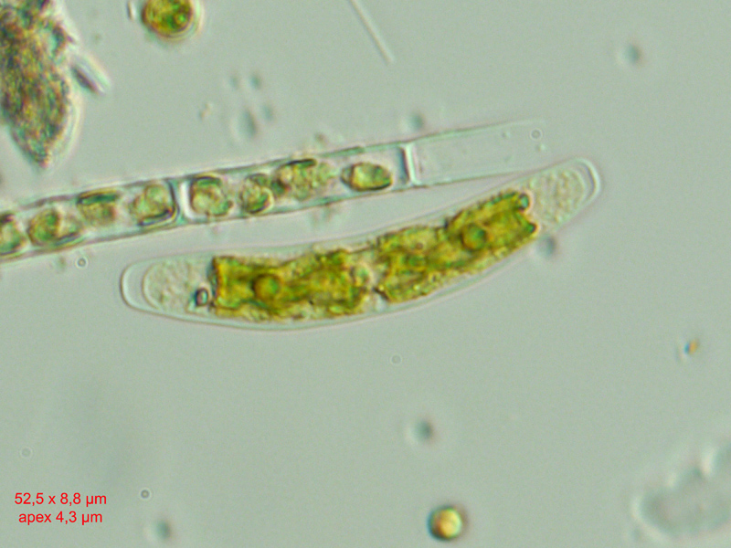Closterium pusillum #58069