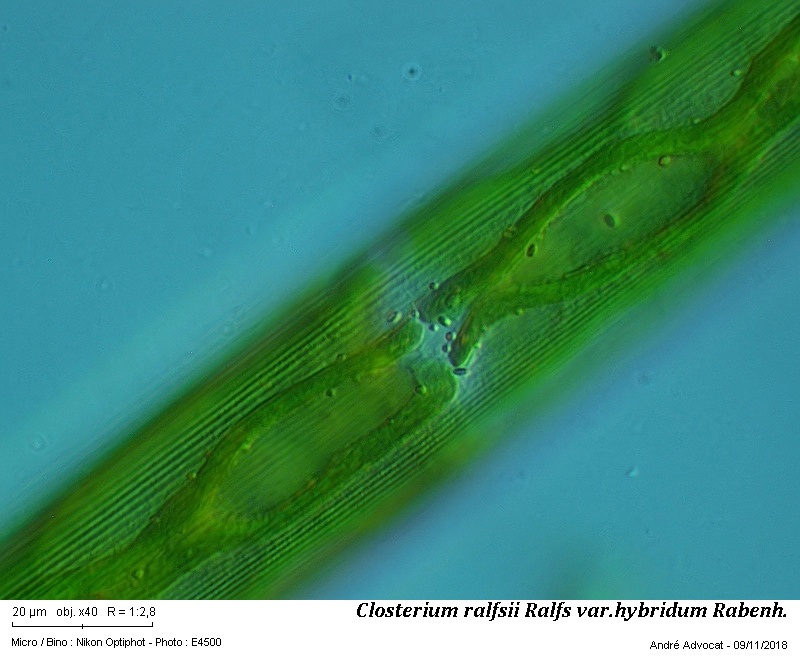 Closterium ralfsii Ralfs var.hybridum Rabenh. #56880