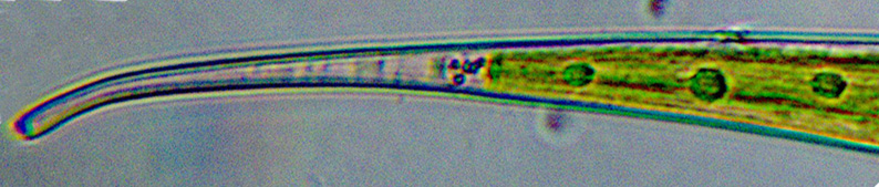 Closterium rostratum #81760