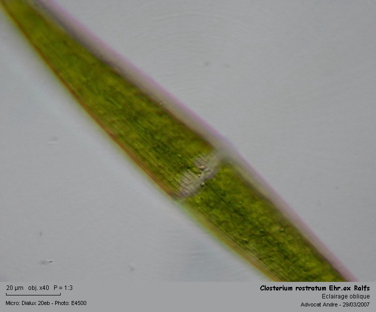 Closterium rostratum Ehr.ex Ralfs #1964