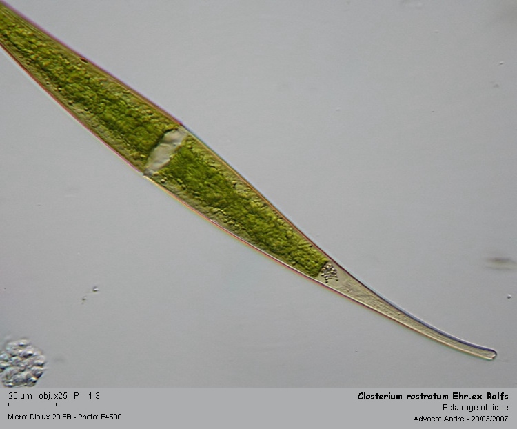 Closterium rostratum Ehr.ex Ralfs #1965