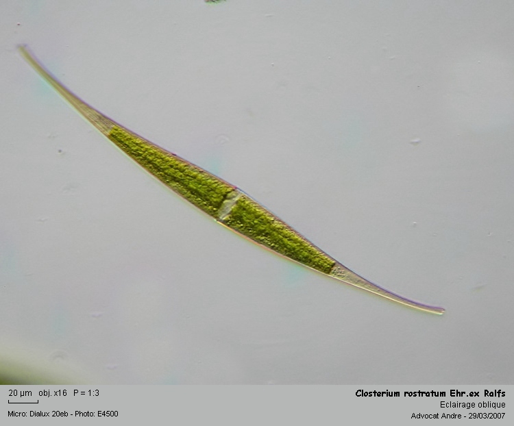 Closterium rostratum Ehr.ex Ralfs #1963