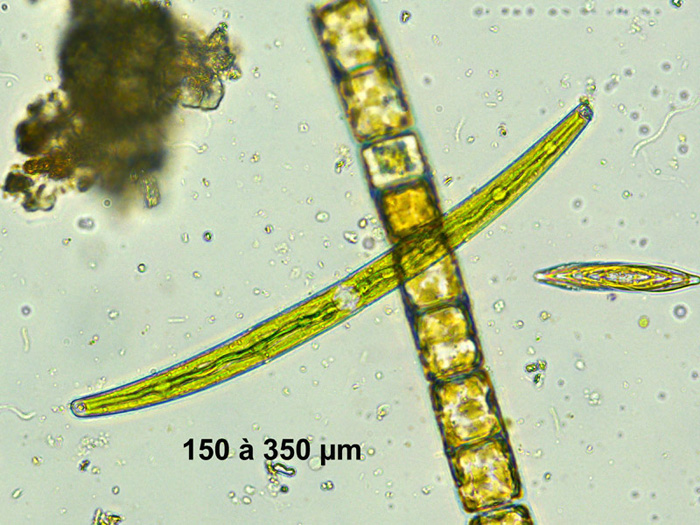 Closterium toxon #62661