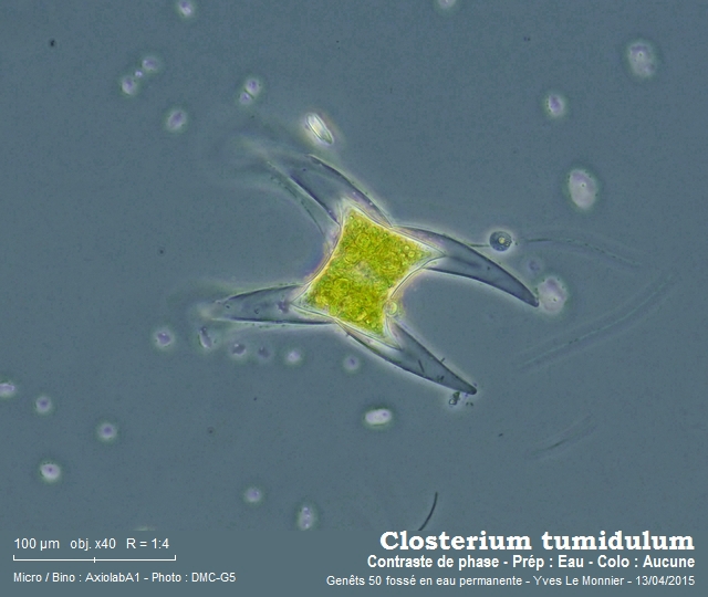 Closterium tumidulum #47324