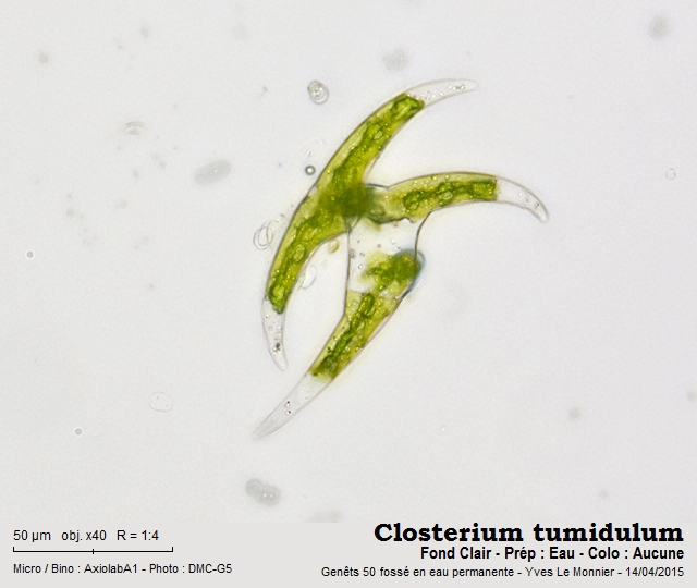 Closterium tumidulum #47322
