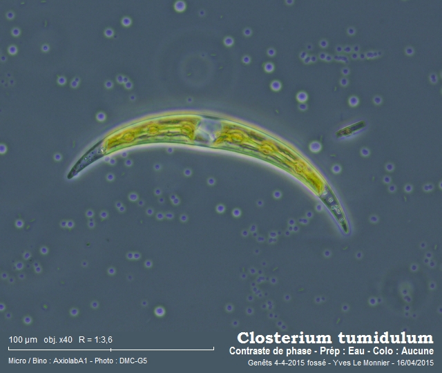 Closterium tumidulum #47325