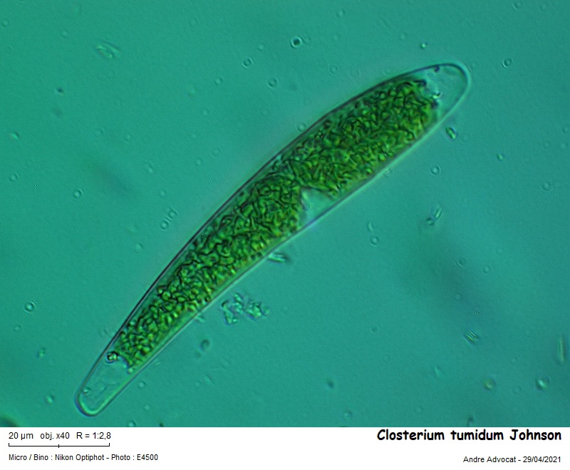 Closterium tumidum Johnson #66502
