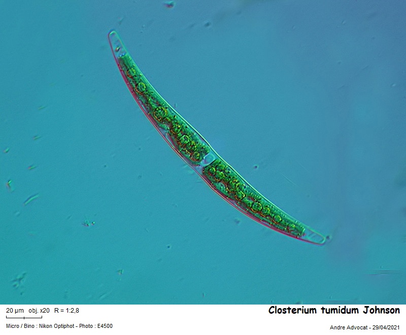 Closterium tumidum Johnson #66501