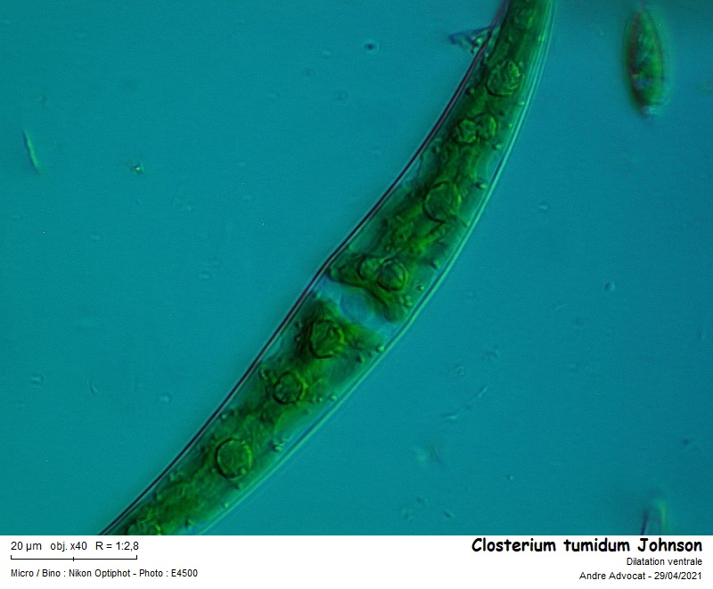Closterium tumidum Johnson #66498