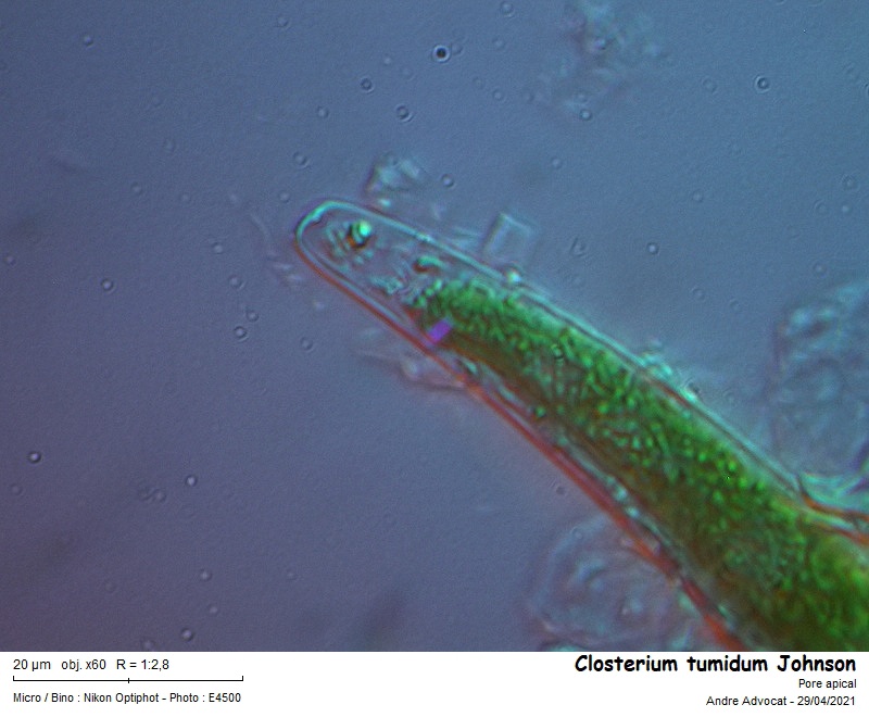 Closterium tumidum Johnson #66500