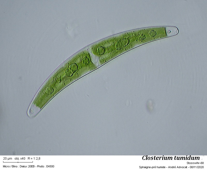 Closterium tumidum Johns. #64758