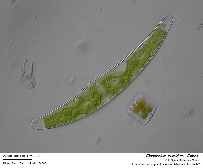 Closterium tumidum Johnson #72248