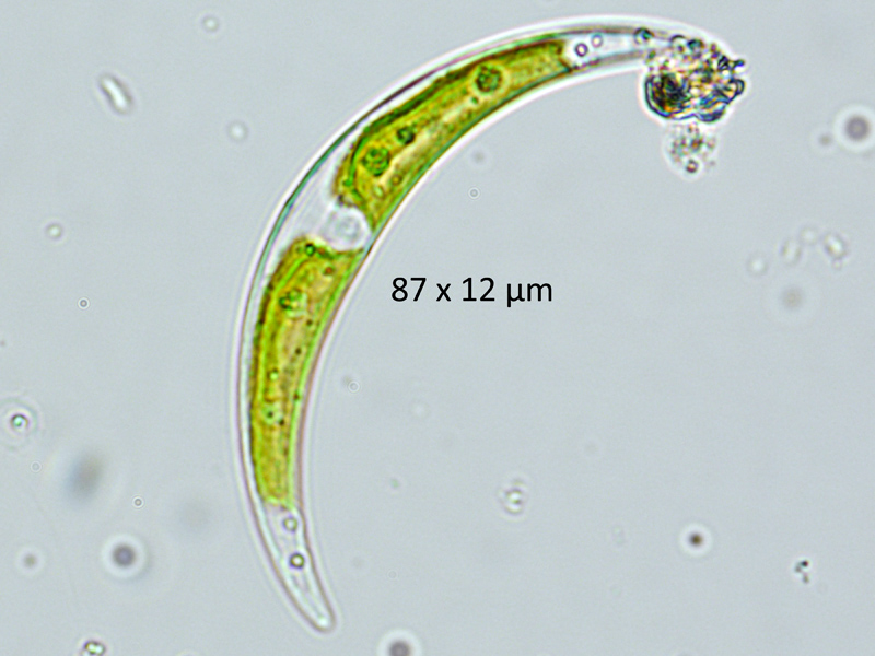 Closterium venus Kützing ex Ralfs, 1848 #65442