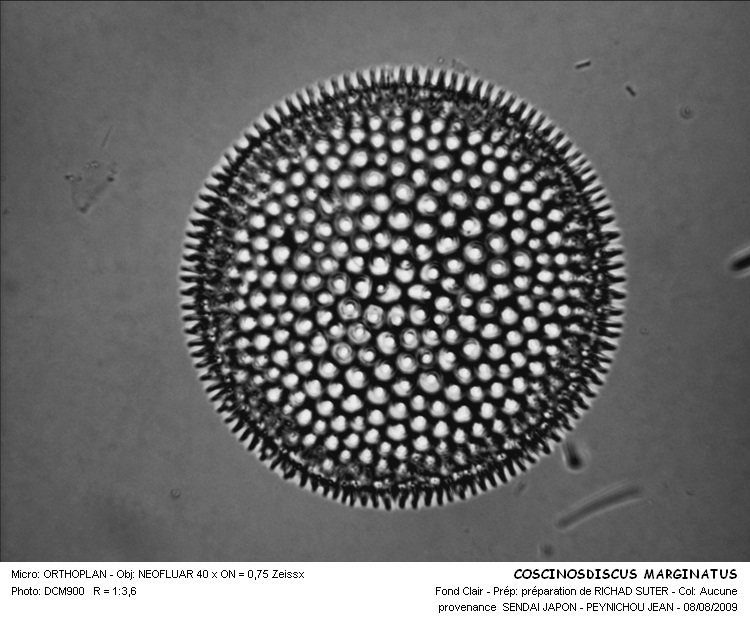 COCCONEIS GRANULIFERA #35934
