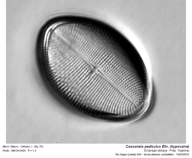 Cocconeis pediculus Ehr. #15241