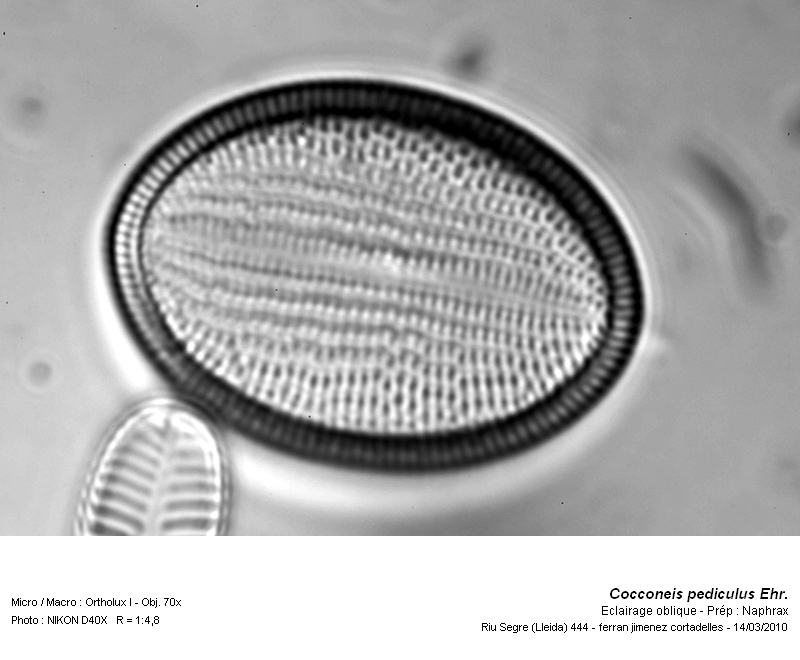 Cocconeis pediculus Ehr. #15242