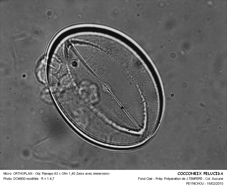 COCCONEIS PELUCIDA #32229