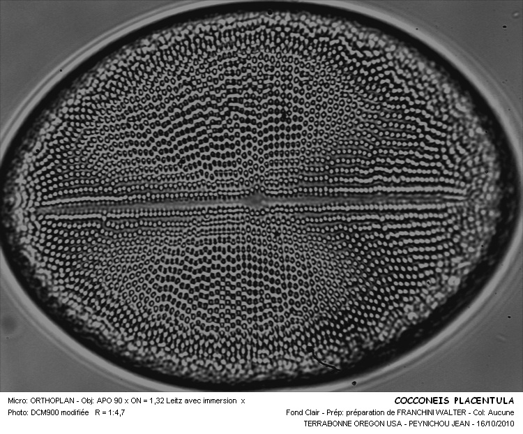 COCCONEIS PLACENTULA #32225