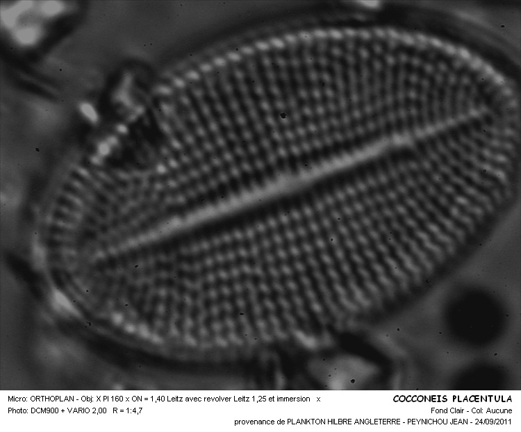 COCCONEIS PLACENTULA #32226
