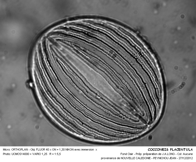 COCCONEIS PLACENTULA #32227