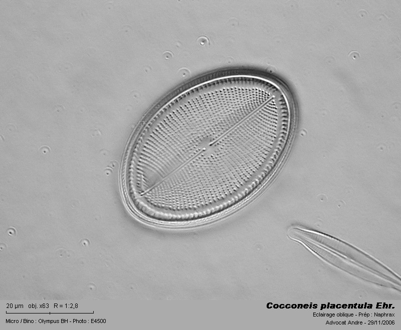 Cocconeis placentula Ehr. #3368