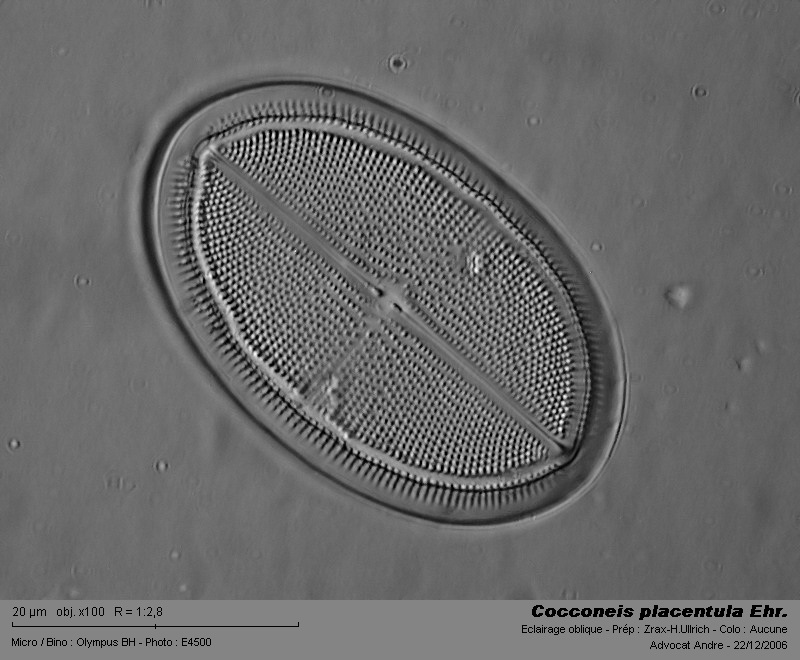 Cocconeis placentula Ehr. #3367