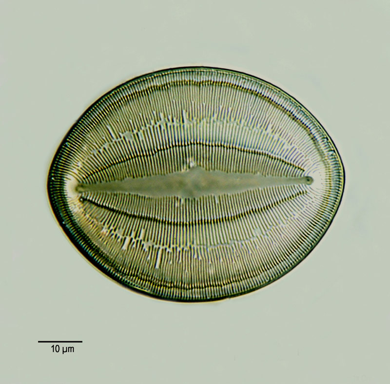 Cocconeis pseudomarginata Greg. #14650