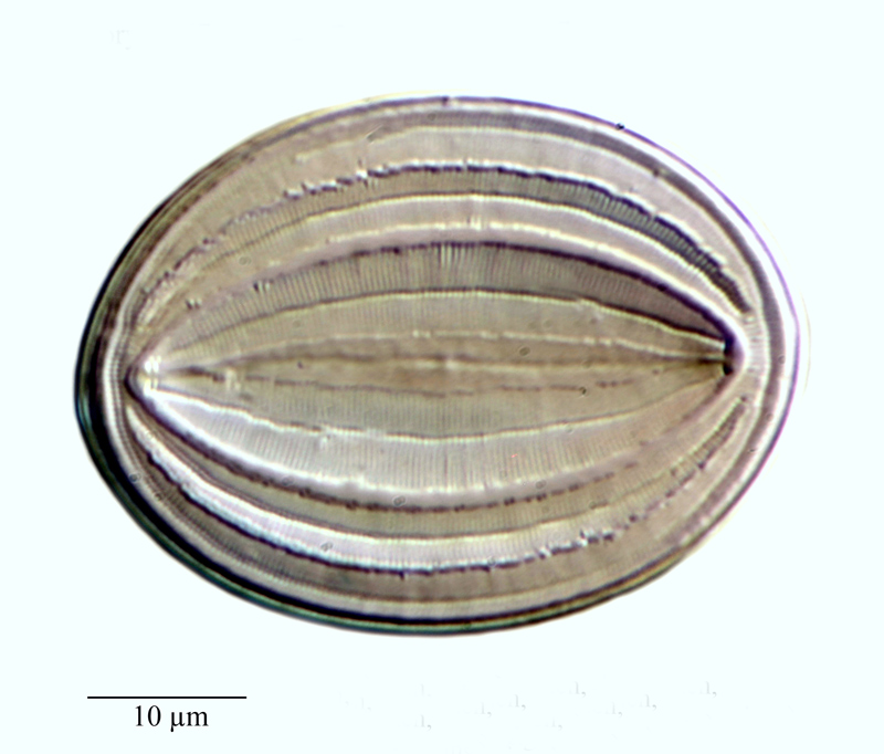 Cocconeis pseudomarginata #75748