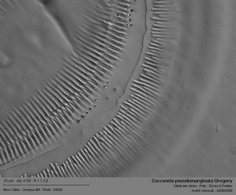 Cocconeis pseudomarginata Gregory (Diatomée marine) #5743