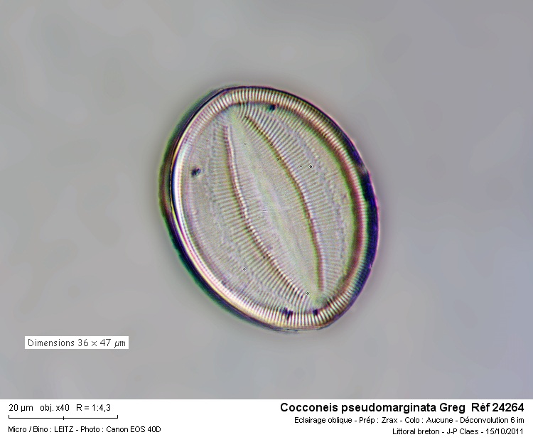 Cocconeis pseudomarginata Gregory #24350