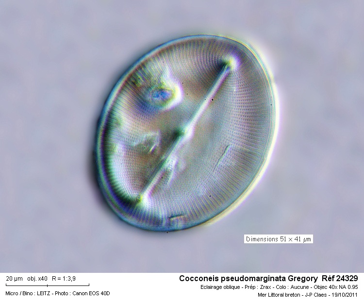 Cocconeis pseudomarginata Gregory #24352
