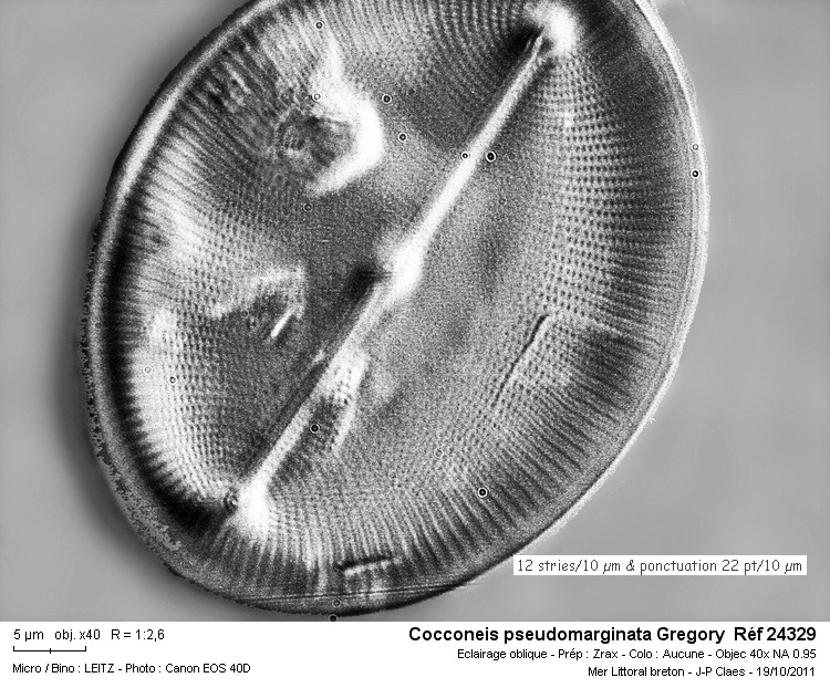 Cocconeis pseudomarginata Gregory #24354